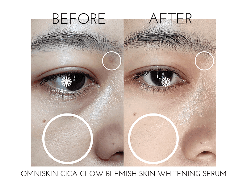 review-omniskin-cica-glow-blemish-skin-whitening-serum