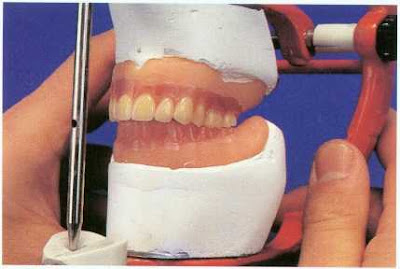 Dentistry lectures for MFDS/MJDF/NBDE/ORE: A Note On ...
