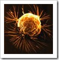 breast cancer6