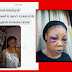 WTHeck!!! See What A Nigerian Man Did To His Wife… We Know About Blue-Black Beating… But This Is All Shades Of Colors, Even Purple!