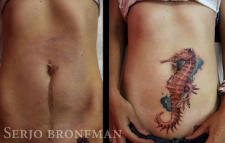 tatuaje cicatriz abdomen