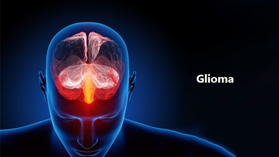 Glioma Tümör Hastalığı Nedir?
