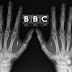 Το BBC προπαγανδίζει για άλλη μια φορά υπέρ της Εμφύτευσης Μικροτσίπ.