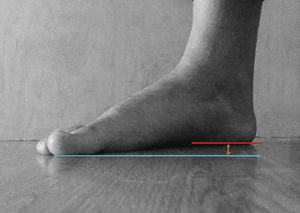 The heel of the foot.