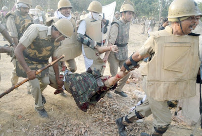 injured policeman