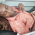 CRIME: Taraba Man Whose Wife Cut Off His Manhood Cries Out