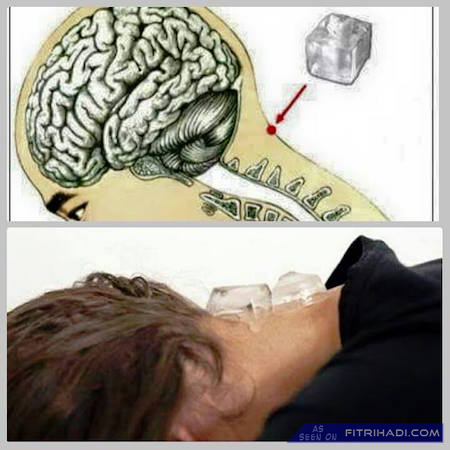 Open Minda: Tips Hilangkan Sakit Kepala / Migrain 