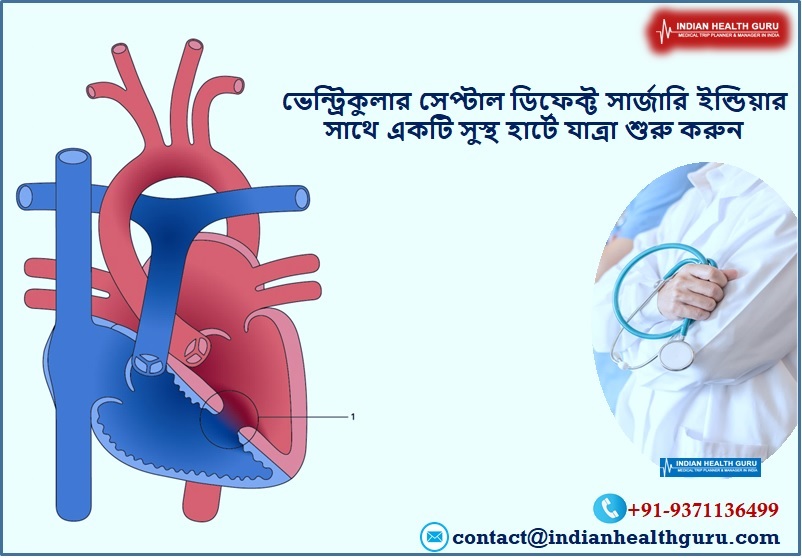 ভেন্ট্রিকুলার সেপ্টাল ডিফেক্ট সার্জারি ইন্ডিয়া