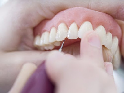 Phương pháp bọc răng sứ có đau không 1