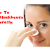 How To Remove Blackheads Naturally