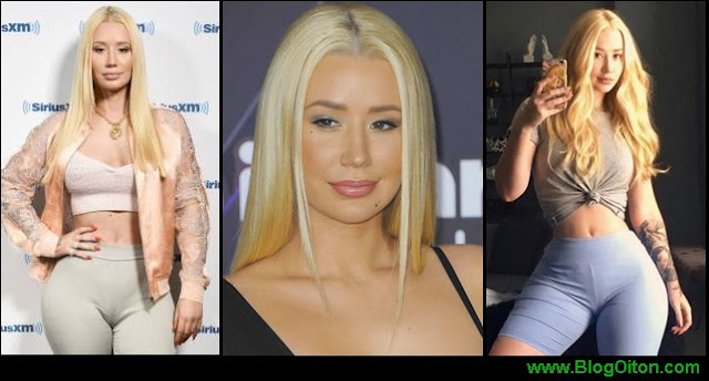 Iggy Azalea revela acidente com depilacao