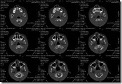 pemeriksaan radiology dengan ct scan