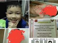 Hoax Penculikan Anak Untuk Dijual Organnya