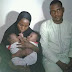 [BREAKING NEWS] Nigerian Doctors separate conjoined twins in Federal Medical Center Yola