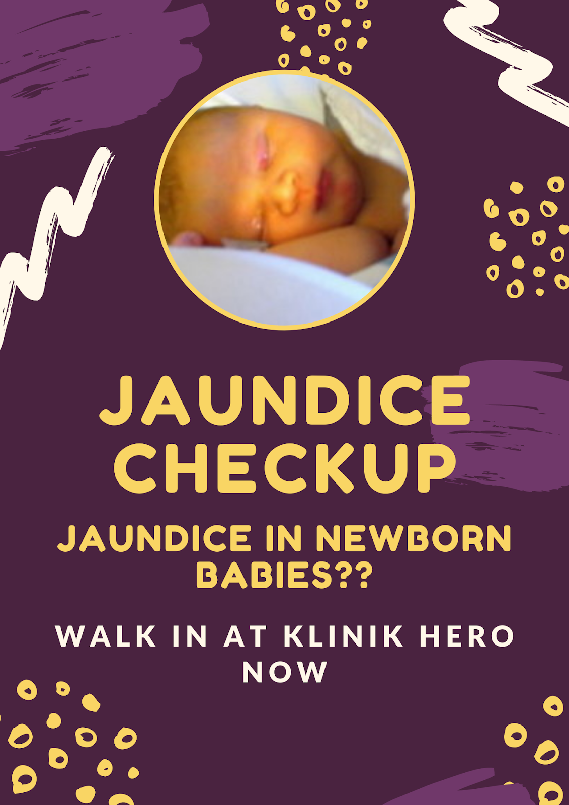Klinik Hero: Kuning Bayi (jaundice) dan test air kencing