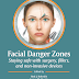 Facial Danger Zones PDF + Video Download | Staying safe with surgery fillers and noninvasive devices 1st