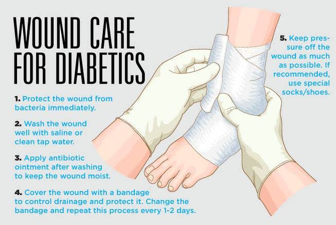 Cara merawat luka diabetes Cara merawat luka diabetes