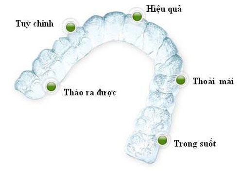 Niềng răng Invisalign được thiết kế đặc biệt mang đến cảm giác thoải mái cho người dùng