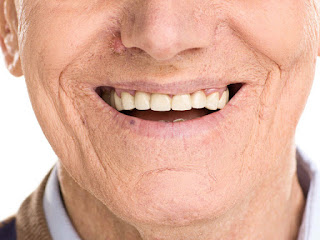Chăm sóc răng sau khi cắm implant-2