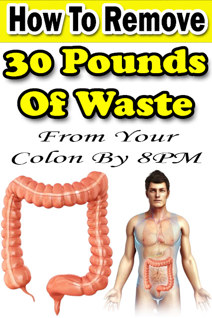 How To Remove 30 Pounds Of Waste From Your Colon By 8PM