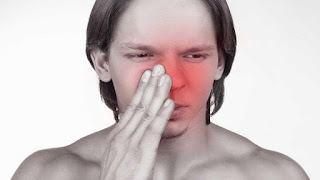 Penyakit Sinusitis Pada Hidung