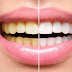 Κιτρίνισμα δοντιών: Οι 6 τροφές που πρέπει να αποφεύγετε