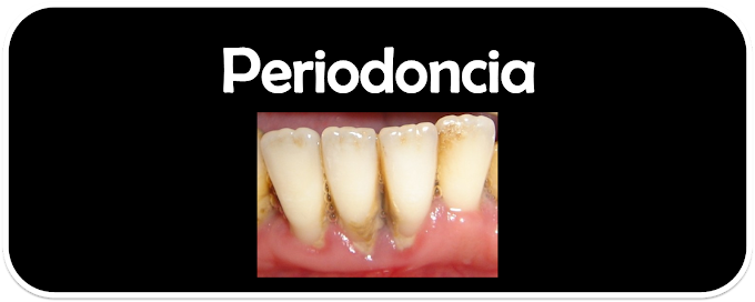 Periodoncia – Efectos y Prevención (Odontología)