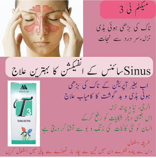 mektum-t-no-3-for-sinusitis