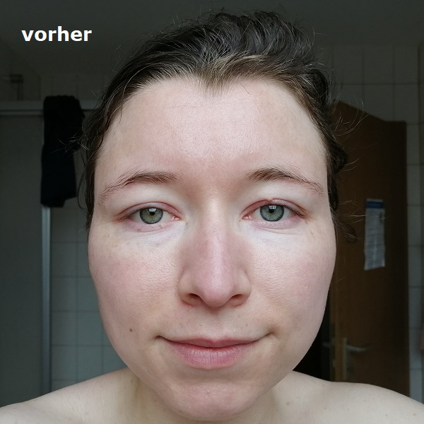 Haut vorher