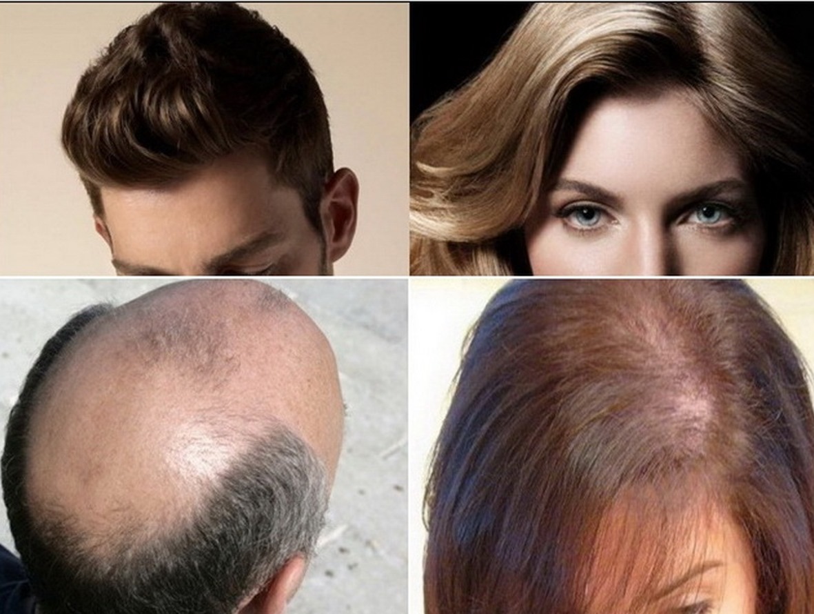 Cara Menebalkan Rambut Tipis Secara Alami Tips Merawat Tubuh Tetap
