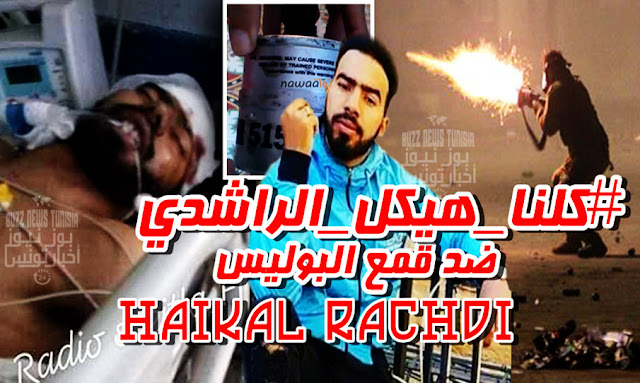 Tunisie - Manifestant Haikal Rachdi blessé à la tête à Sbeitla Kasserine : que s'est-il passé ?