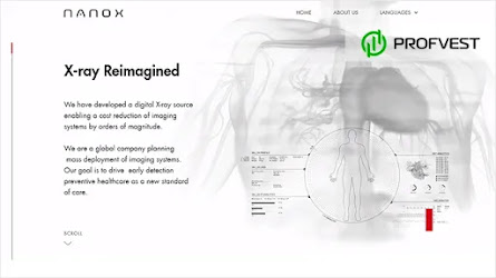 💸IPO от компании Nano-X Imagine: перспективы и возможность заработка
