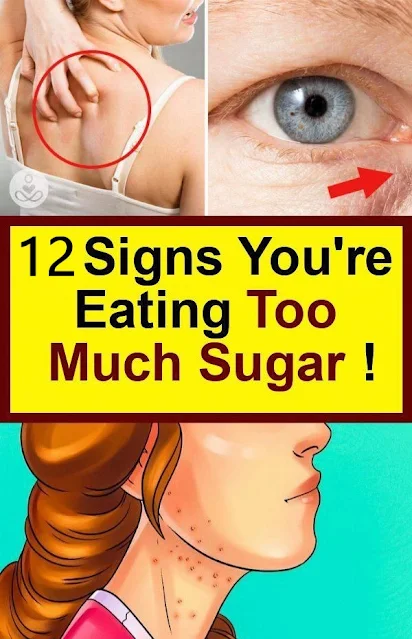 12 Signs You’re Eating Too Much Sugar