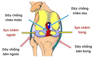 Triệu chứng rách dây chằng chéo bên đầu gối sau