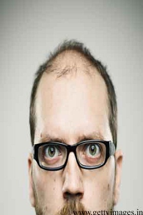 Why you should not ignore hair loss