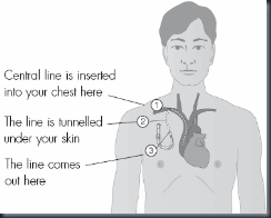 Central Line Diagram