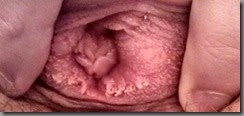 vaginal-opening