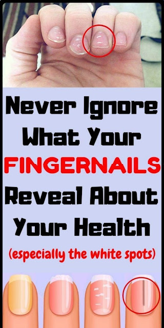 Guide To Deciphering Your Fingernail Health & What To Do About It!