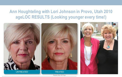 ageloc transformation nuskin