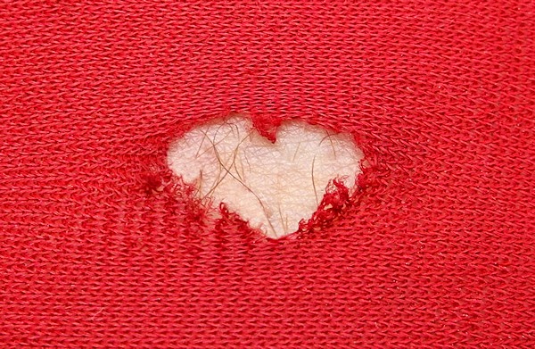 Dziura w kształcie serca w ubranych czerwonych spodenkach kolarskich z wystającymi włoskami na udzie