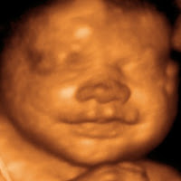 3d Ultrasound Baby2