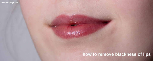 how to remove blackness of lips