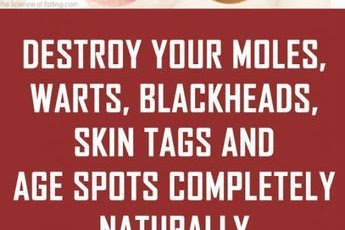 DESTROY YOUR MOLES, WARTS, BLACKHEADS, SKIN TAGS AND AGE SPOTS COMPLETELY NATURALLY