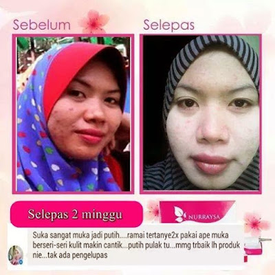 Nurraysa Beauty Skincare Murah