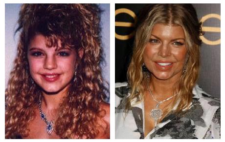 lady gaga before plastic surgery before after. Fergie Plastic Surgery Before