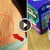 How To Remove Stretch Marks By Using Vicks Vaporub