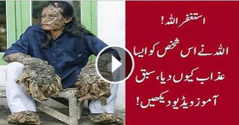 Amazing, VIDEO, man turned into tree, shocking story, maan turned into tree, tree man, 