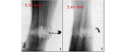 Разрушение пули о трубчатые кости