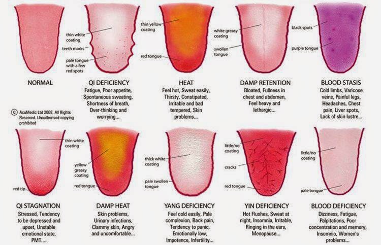 What Does Your Tongue Say About Your State Of Health?