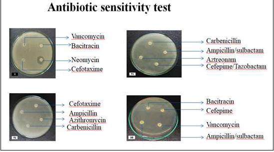 The antibiotic sensitivity test was conducted on ESBL strains, and the results revealed that all of them exhibited resistance, as evidenced by the absence of zone formation.